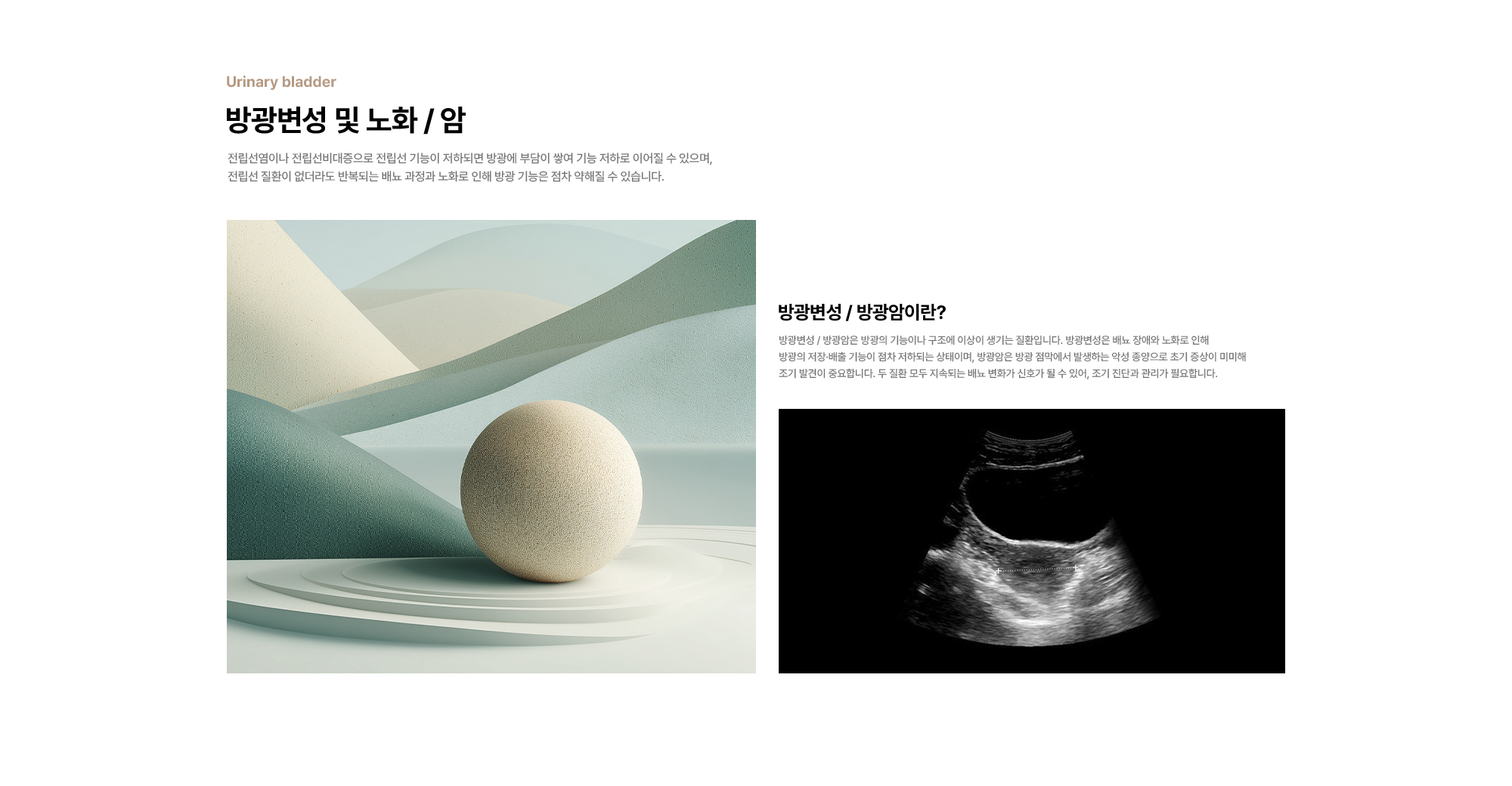 
        방광변성 및 노화 / 암 : 전립선염이나 전립선비대증으로 전립선 기능이 저하되면 방광에 부담이 
        쌓여 기능 저하로 이어질 수 있으며, 전립선 질환이 없더라도 반복되는 배뇨 과정과 노화로 인해 방광 기능은 점차 약해질 수 있습니다.
        방광변성 / 방광암이란? 방광변성 / 방광암은 방광의 기능이나 구조에 이상이 생기는 질환입니다.
        방광변성은 배뇨 장애와 노화로 인해 방광의 저장·배출 기능이 점차 저하되는 상태이며,
        방광암은 방광 점막에서 발생하는 악성 종양으로 초기 증상이 미미해 조기 발견이 중요합니다.
        두 질환 모두 지속되는 배뇨 변화가 신호가 될 수 있어, 조기 진단과 관리가 필요합니다.