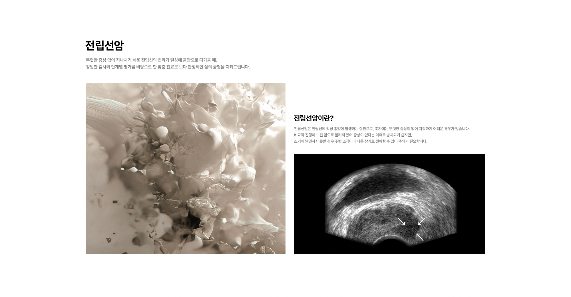 
        전립선암 : 뚜렷한 증상 없이 지나치기 쉬운 전립선의 변화가 일상에 불안으로 다가올 때, 정밀한 검사와 단계별 평가를 바탕으로 한 맞춤 진료로 보다 안정적인 삶의 균형을 지켜드립니다.
        전립선암이란? 전립선암은 전립선에 악성 종양이 발생하는 질환으로, 초기에는 뚜렷한 증상이 없어 자각하기 어려운 경우가 많습니다.