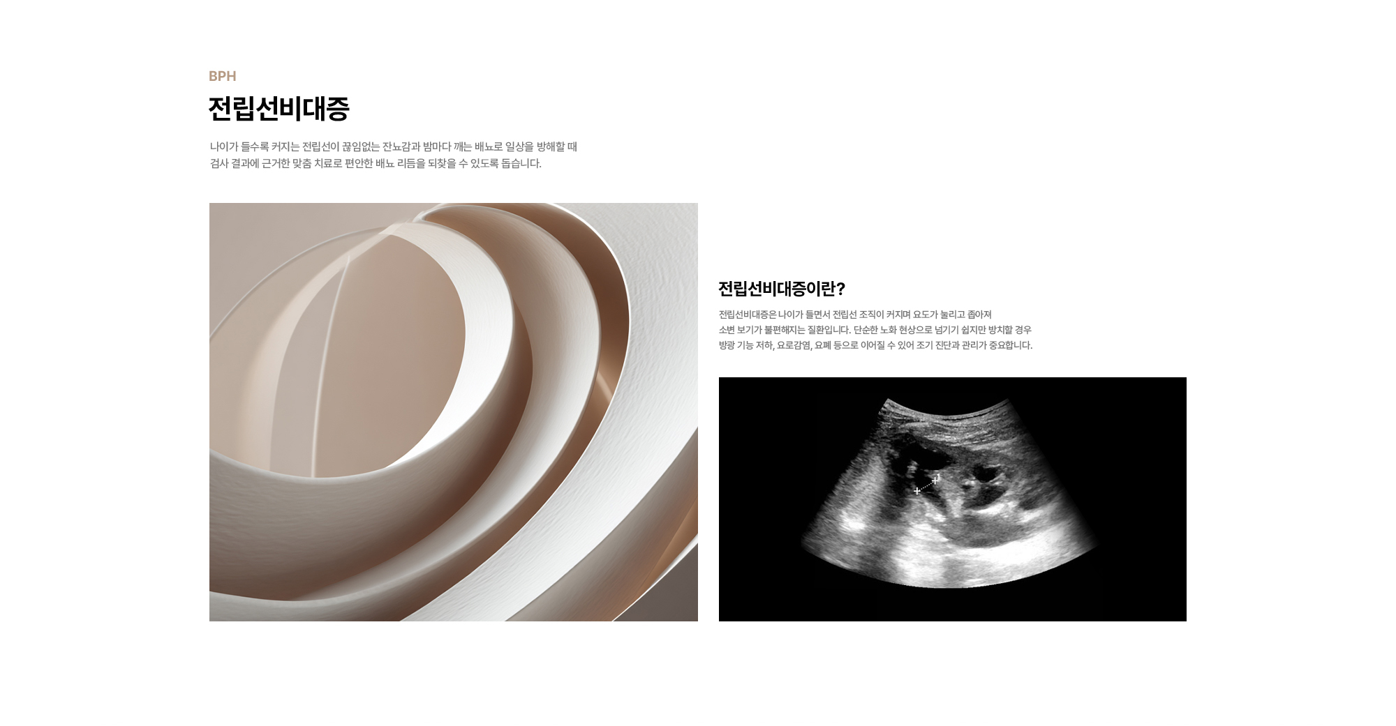 
        전립선비대증 : 나이가 들수록 커지는 전립선이 끊임없는 잔뇨감과 밤마다 깨는 배뇨로 일상을 방해할 때 검사 결과에 근거한 맞춤 치료로 편안한 배뇨 리듬을 되찾을 수 있도록 돕습니다.
        전립선비대증이란 : 전립선비대증은 나이가 들면서 전립선 조직이 커지며 요도가 눌리고 좁아져 소변 보기가 불편해지는 질환입니다. 단순한 노화 현상으로 넘기기 쉽지만 방치할 경우
        방광 기능 저하, 요로감염, 요폐 등으로 이어질 수 있어 조기 진단과 관리가 중요합니다.