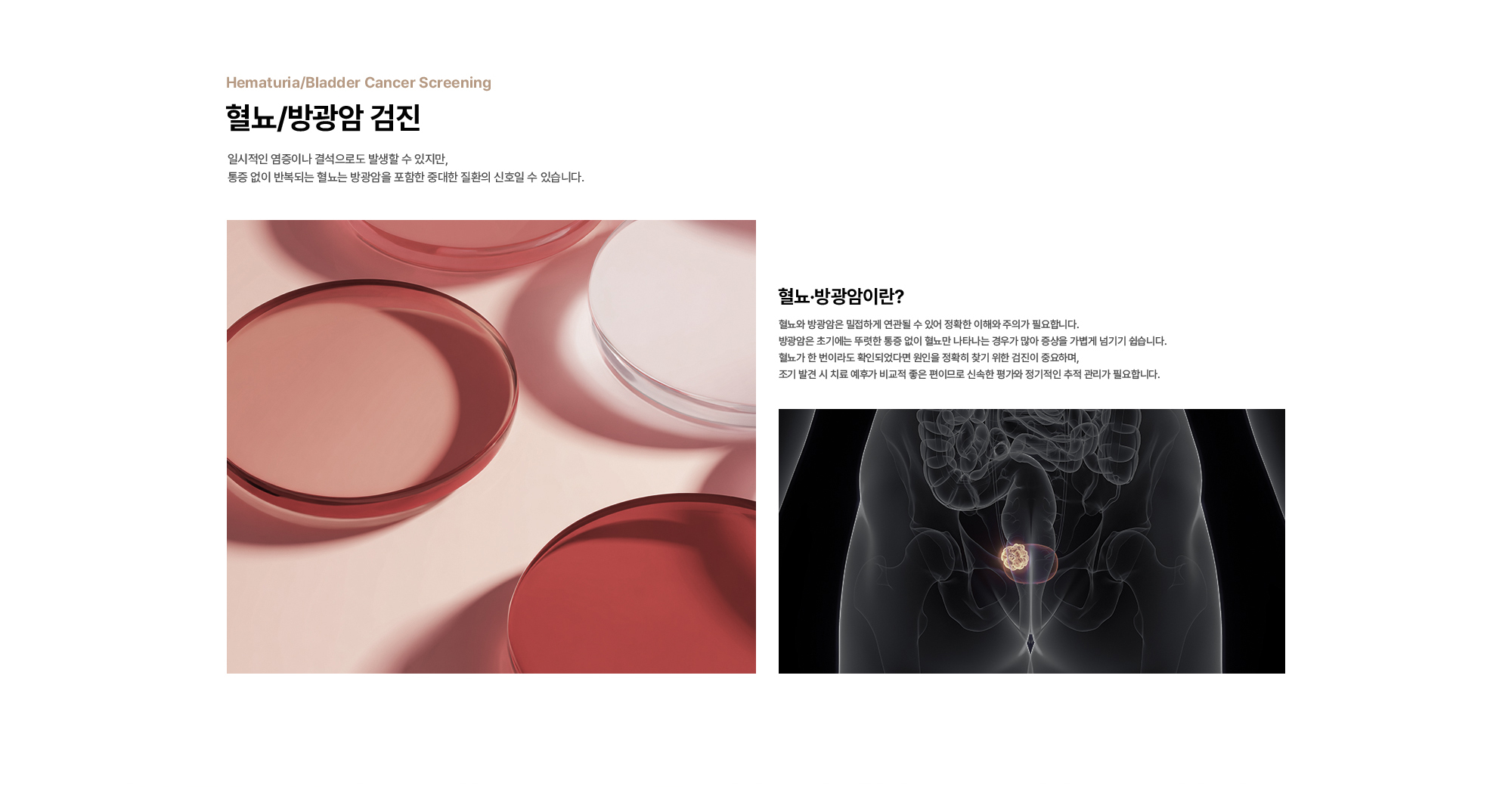 혈뇨/방광암 검진 : 일시적인 염증이나 결석으로도 발생할 수 있지만, 통증 없이 반복되는 혈뇨는 방광암을 포함한 중대한 질환의 신호일 수 있습니다. 혈뇨·방광암이란? 혈뇨와 방광암은 밀접하게 연관될 수 있어 정확한 이해와 주의가 필요합니다. 방광암은 초기에는 뚜렷한 통증 없이 혈뇨만 나타나는 경우가 많아 증상을 가볍게 넘기기 쉽습니다. 혈뇨가 한 번이라도 확인되었다면 원인을 정확히 찾기 위한 검진이 중요하며, 조기 발견 시 치료 예후가 비교적 좋은 편이므로 신속한 평가와 정기적인 추적 관리가 필요합니다.