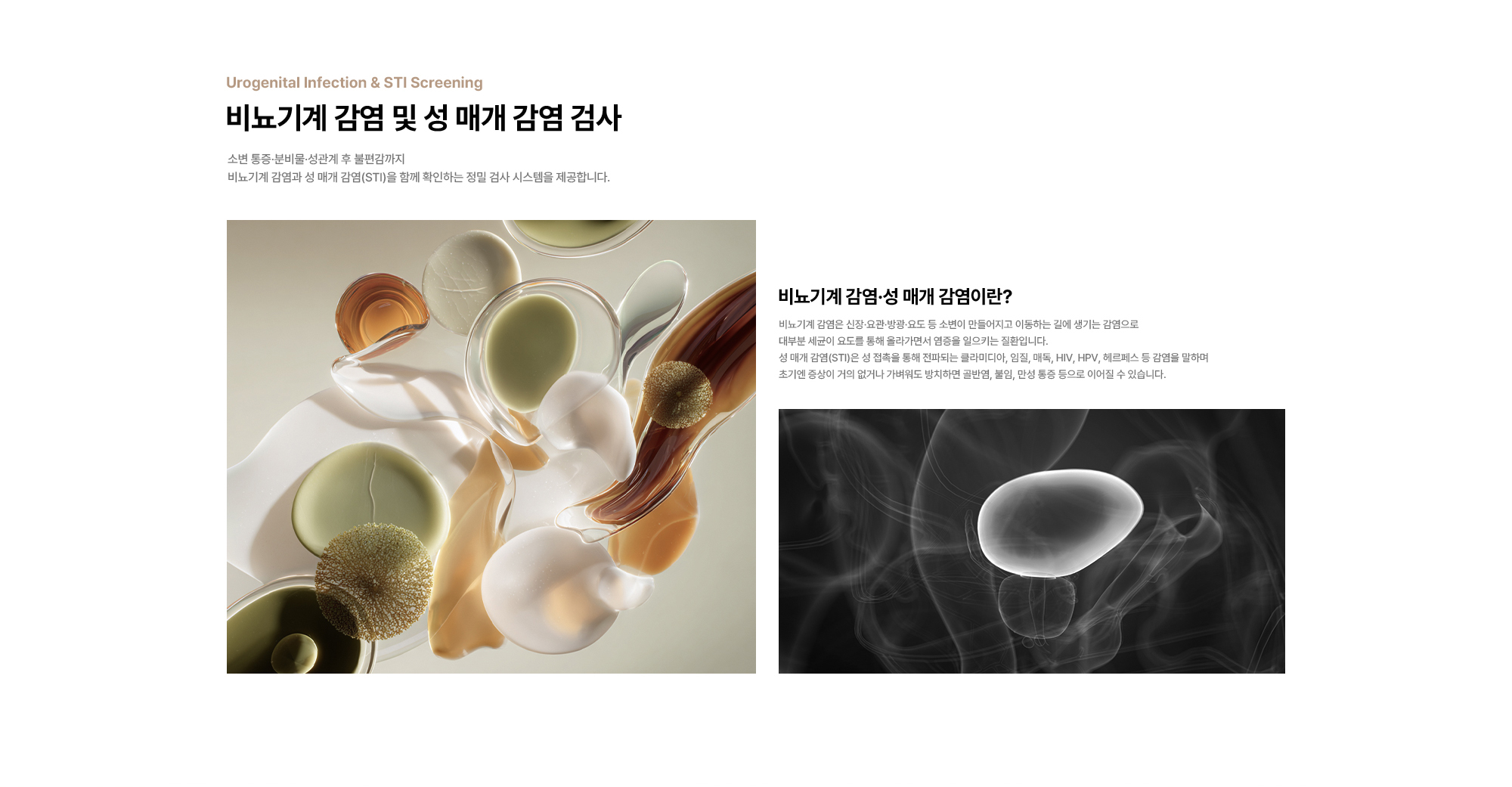 비뇨기계 감염 및 성 매개 감염 검사 : 소변 통증·분비물·성관계 후 불편감까지 비뇨기계 감염과 성 매개 감염(STI)을 함께 확인하는 정밀 검사 시스템을 제공합니다. 비뇨기계 감염·성 매개 감염이란? 비뇨기계 감염은 신장·요관·방광·요도 등 소변이 만들어지고 이동하는 길에 생기는 감염으로 대부분 세균이 요도를 통해 올라가면서 염증을 일으키는 질환입니다. 성 매개 감염(STI)은 성 접촉을 통해 전파되는 클라미디아, 임질, 매독, HIV, HPV, 헤르페스 등 감염을 말하며초기엔 증상이 거의 없거나 가벼워도 방치하면 골반염, 불임, 만성 통증 등으로 이어질 수 있습니다.