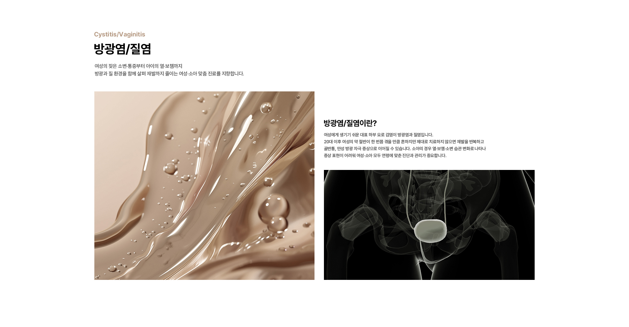
        방광염/질염 : 여성의 잦은 소변·통증부터 아이의 열·보챔까지 방광과 질 환경을 함께 살펴 재발까지 줄이는 여성·소아 맞춤 진료를 지향합니다.
        방광염/질염이란? 여성에게 생기기 쉬운 대표 하부 요로 감염이 방광염과 질염입니다.
        20대 이후 여성의 약 절반이 한 번쯤 겪을 만큼 흔하지만 제대로 치료하지 않으면 재발을 반복하고
        골반통, 만성 방광 자극 증상으로 이어질 수 있습니다. 소아의 경우 열·보챔·소변 습관 변화로 나타나
        증상 표현이 어려워 여성·소아 모두 연령에 맞춘 진단과 관리가 중요합니다.