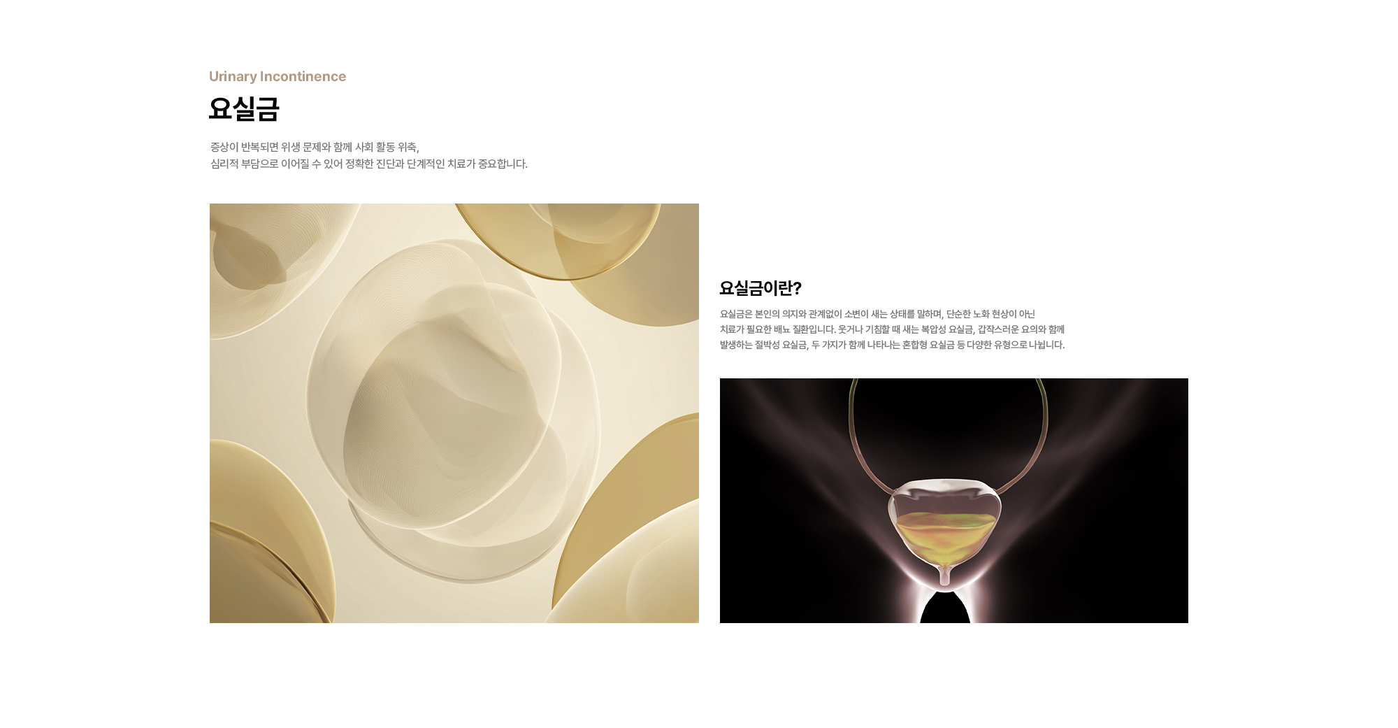 요실금 : 증상이 반복되면 위생 문제와 함께 사회 활동 위축, 심리적 부담으로 이어질 수 있어 정확한 진단과 단계적인 치료가 중요합니다. 요실금이란? 요실금은 본인의 의지와 관계없이 소변이 새는 상태를 말하며, 단순한 노화 현상이 아닌 치료가 필요한 배뇨 질환입니다. 웃거나 기침할 때 새는 복압성 요실금, 갑작스러운 요의와 함께 발생하는 절박성 요실금, 두 가지가 함께 나타나는 혼합형 요실금 등 다양한 유형으로 나뉩니다.
