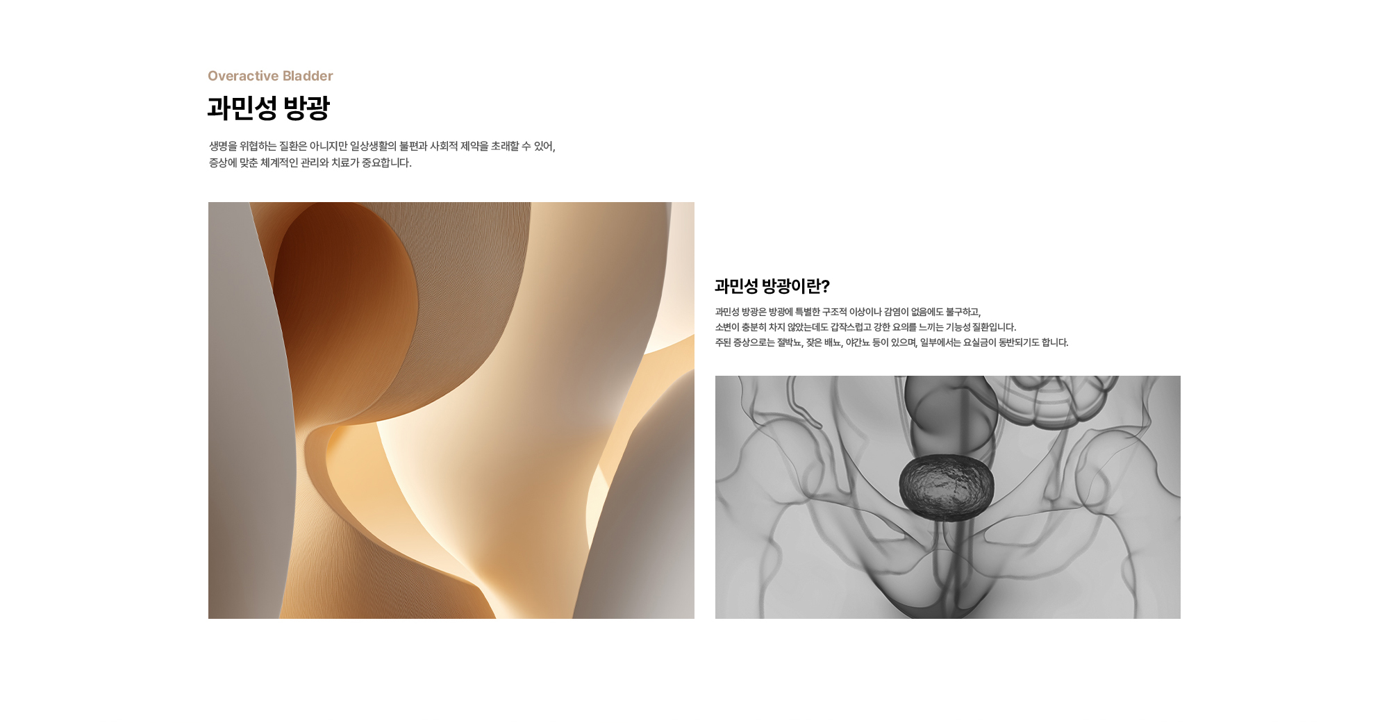 과민성 방광 : 생명을 위협하는 질환은 아니지만 일상생활의 불편과 사회적 제약을 초래할 수 있어, 증상에 맞춘 체계적인 관리와 치료가 중요합니다. 과민성 방광이란? 과민성 방광은 방광에 특별한 구조적 이상이나 감염이 없음에도 불구하고, 소변이 충분히 차지 않았는데도 갑작스럽고 강한 요의를 느끼는 기능성 질환입니다. 주된 증상으로는 절박뇨, 잦은 배뇨, 야간뇨 등이 있으며, 일부에서는 요실금이 동반되기도 합니다. 